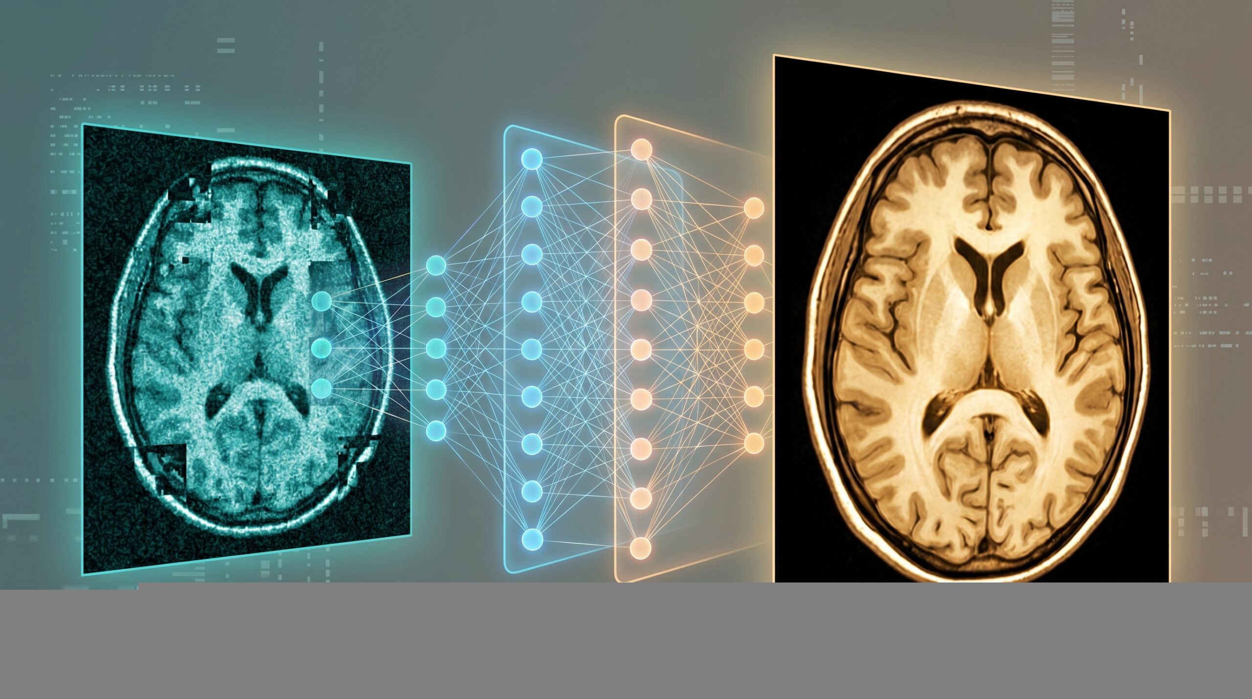 Deep Learning MRI Reconstruction in 2026